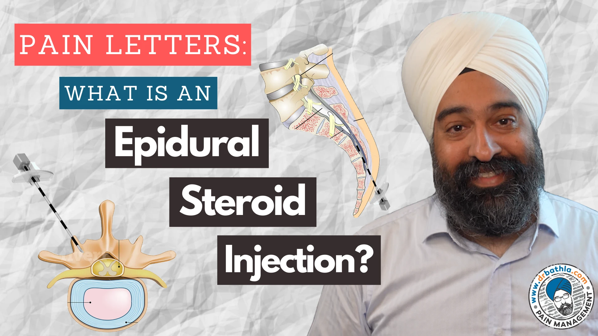 What Does an Epidural Steroid Injection Procedure Really Involve?